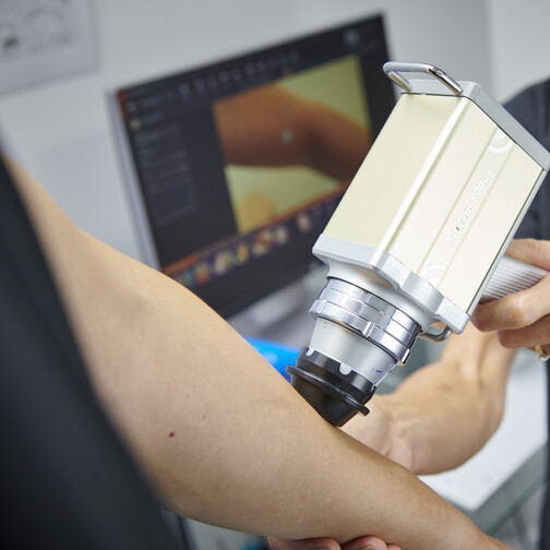 Naevus Mole Mapping at Hamilton Skin Cancer Centre