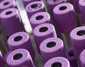 New BVD ear punch PCR test available