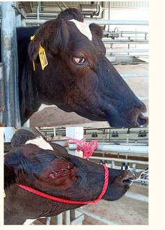 Eye Removal due to Tumour