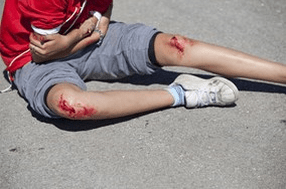 Skin Infections