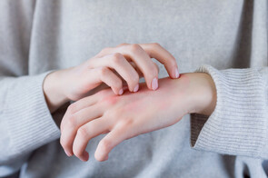 Scabies