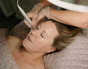 Dermal Needling