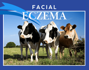 Facial Eczema in NZ Dairy Herds