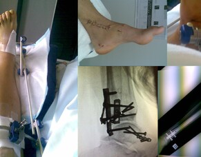 Unleashed Potential: Mary shares some of the backstory behind the Live Life Wide Open Track