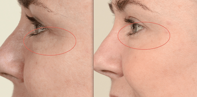 Healthy Skin | Louise Grey