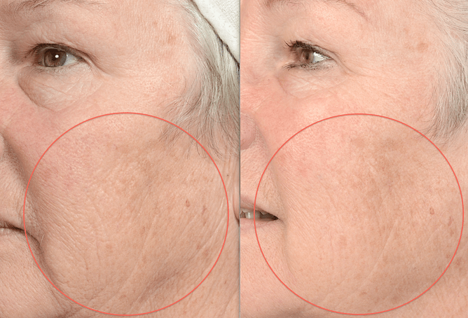 Healthy Skin | Louise Grey