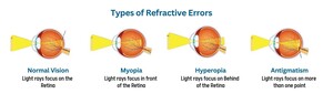 Demystifying Refractive Errors: A Guide to Clear Vision