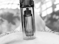 “Microneedling treatment at Jo’s Beauty Room Patumahoe”