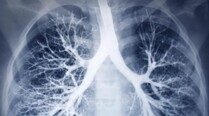 CT Scan Image