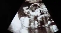 Pregnancy Image