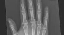 X-Ray Image