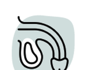 Hydrocoele (Paediatric)