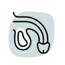 Hydrocoele (Paediatric)