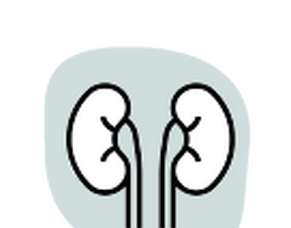 Ureteric Stent