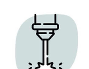Rigid Ureteroscopy and Lasering of Ureteric Stone