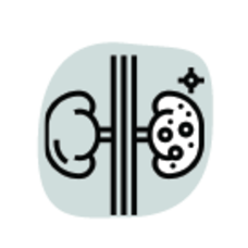 Kidney Stones