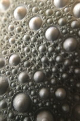 Types of Skin Cancer