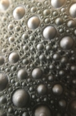 Types of Skin Cancer