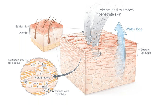 skin sensitivity and skin microbiome assessed through Face Mapping by the skin therapists at Simply Indulgent Taradale Hawke's Bay