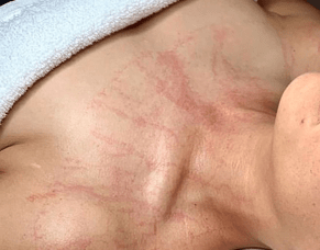 P R I N Lymphatic Therapy Facial