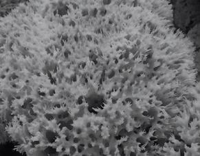 The Cosmedix Deep Sea Peel