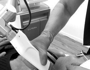 Everything you need to know about our Pico Genesis and PicoGEN FX laser treatments