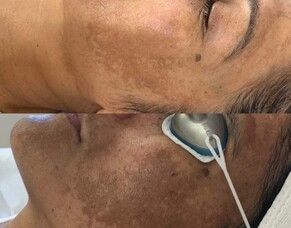 Before & After Shots From Harleh's Clients