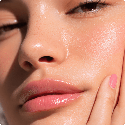 Chemical Peels photo of beautiful woman