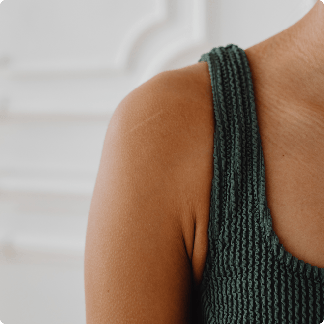 Hyperhidrosis  photo of woman's shoulder