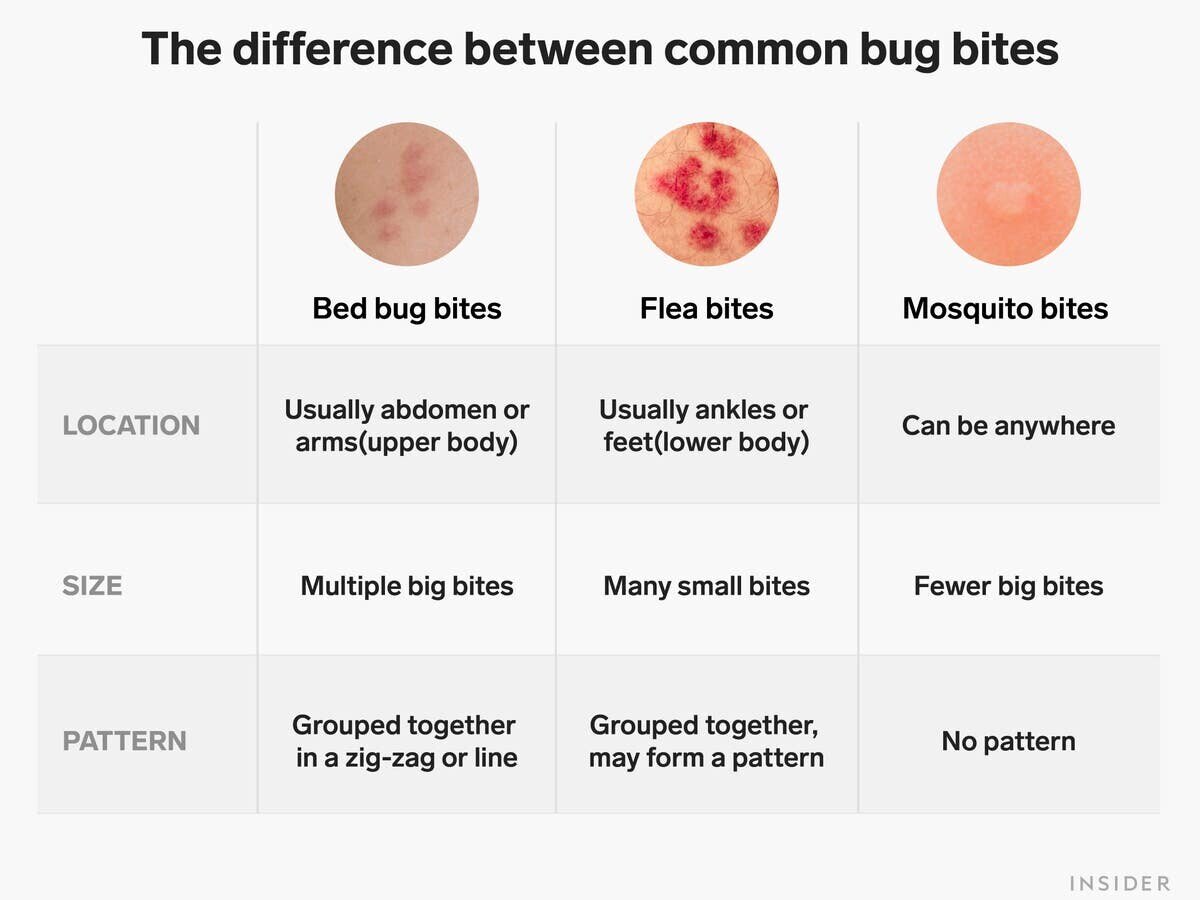 Flea Bites 101 Dan s Property Services Ltd