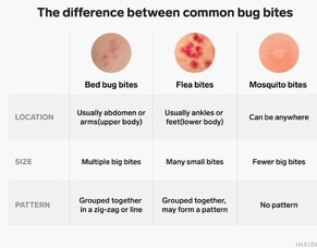 Flea Bites 101