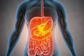 Indigestion