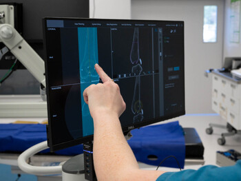 X-ray illustration of a side view of a human knee joint, showing the femur, tibia, and patella, against a dark background.