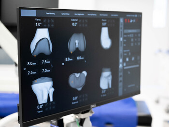 X-ray illustration of a human knee joint, showing detailed outlines of the femur, tibia, and patella, against a dark background.