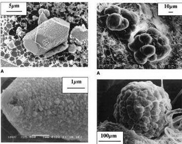 Calcite microcrystals in the human pineal gland