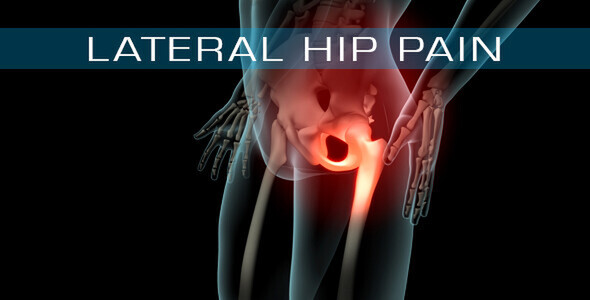 Lateral Hip Pain/ Trochanteric Bursitis