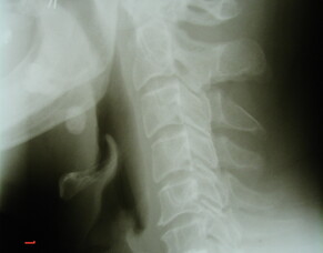 Xray Referral and Interpretation