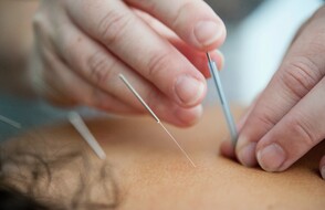 Acupuncture Care