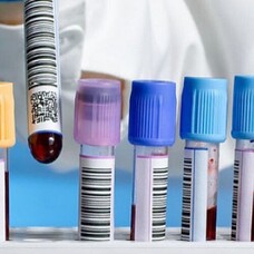 Measles Information Update