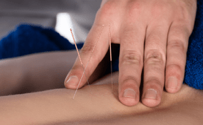 Acupuncture - MR. YU Master Acupuncture & Health Care