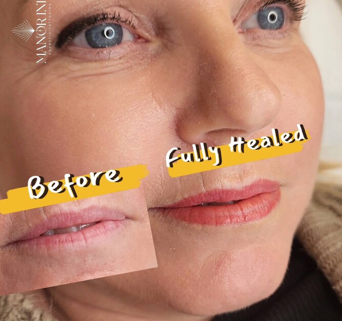 permanent makeup lip tattoos on mature skin before and after