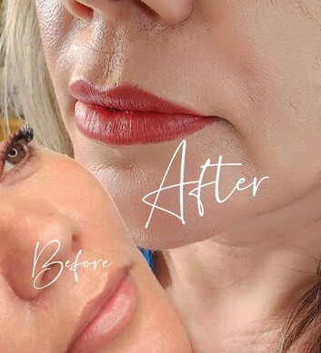 lip tattooing before and after photos by Manor Ink Hamilton