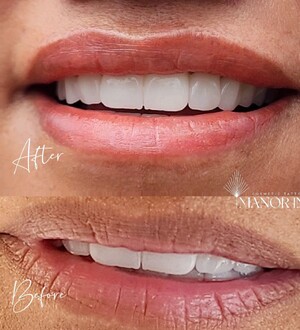 lip tattooing before and after photos by Manor Ink Hamilton