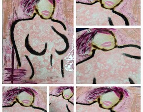 Acknowledgement to Breast Cancer in Exhibition