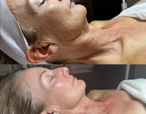 Skin plans at Skinvae - Start here