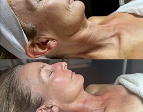 Skin plans at Skinvae - Start here
