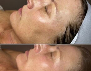 Before &amp; After: Kim