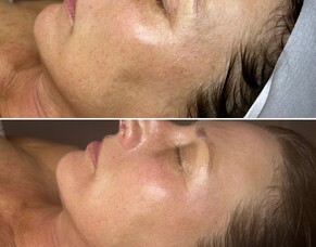 Before &amp; After: Kim