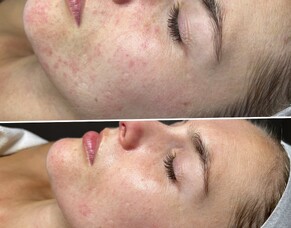 Before &amp; After: Georgia