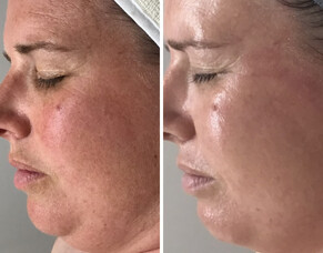 Results or Relaxation?  You don&#039;t have to choose - here&#039;s why